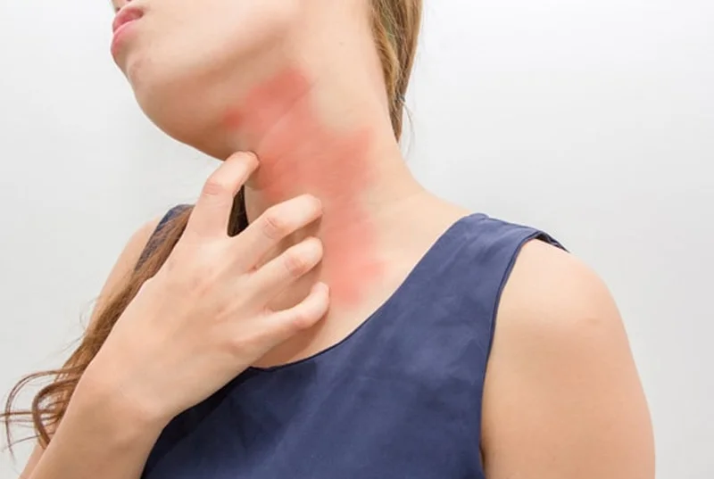 Skin Treatment